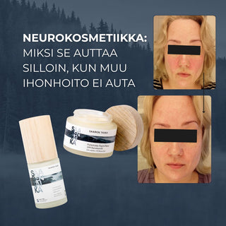 Saaren Taika Neurokosmetiikka rauhoittaa punoitusta ja ärsytystä