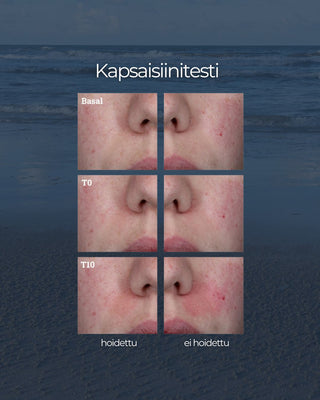 24H Kasvovoide herkälle iholle, kapsaisiinitesti