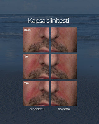 24H Kasvovoide herkälle iholle, kapsaisiinitesti