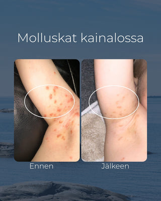 Tea tree tvål, lämplig för t.ex. för kliande eller akne hud, antibakteriell & återfuktande - Saaren Taika 🇫🇮