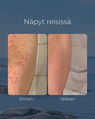 Tea tree tvål, lämplig för t.ex. för kliande eller akne hud, antibakteriell & återfuktande - Saaren Taika 🇫🇮