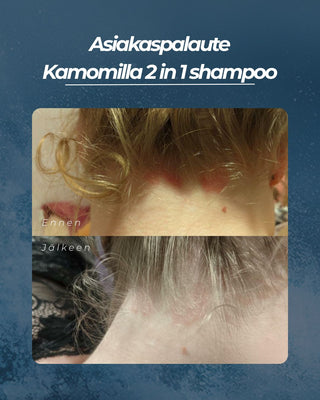 Asiakaspalaute
Kamomilla 2 in 1 shampoo