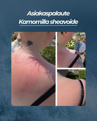 Asiakaspalaute
Kamomilla sheavoide aurinkoihottuma