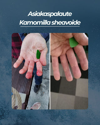 Asiakaspalaute
Kamomilla sheavoide soittajan sormet