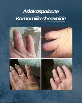 Asiakaspalaute
Kamomilla sheavoide