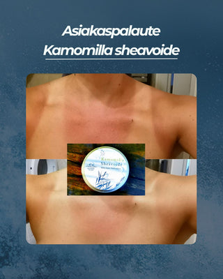 Asiakaspalaute
Kamomilla sheavoide palanut iho