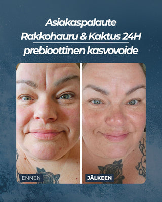 Asiakaspalaute
Rakkohauru & Kaktus 24H prebioottinen kasvovoide