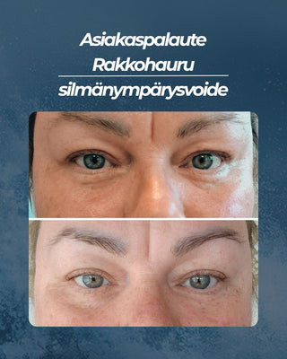 Asiakaspalaute
Rakkohauru silmänympärysvoide