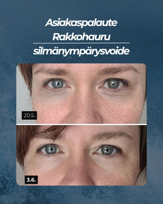 Asiakaspalaute
Rakkohauru silmänympärysvoide