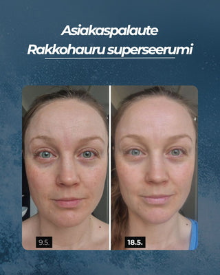 Asiakaspalaute
Rakkohauru superseerumi