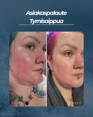 Asiakaspalaute Tyrnisaippua