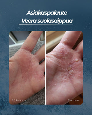 Asiakaspalaute
Veera suolasaippua