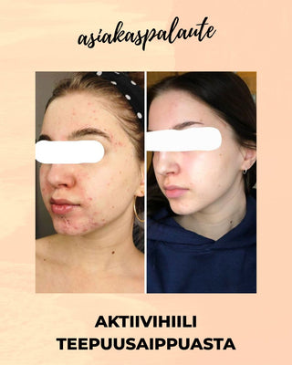 MESSUTARJOUS Aktiivihiili Teepuusaippua, sopii mm. epäpuhtaalle- tai akneiholle, 100% luonnollista, vegaaninen Palasaippua Saaren Taika Handmade