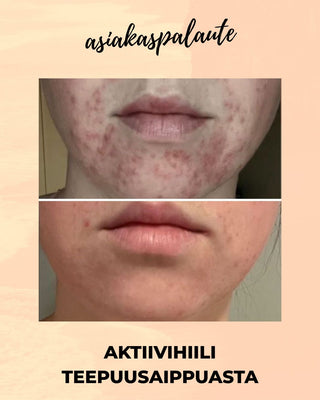 MESSUTARJOUS Aktiivihiili Teepuusaippua, sopii mm. epäpuhtaalle- tai akneiholle, 100% luonnollista, vegaaninen Palasaippua Saaren Taika Handmade