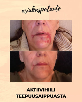 MESSUTARJOUS Aktiivihiili Teepuusaippua, sopii mm. epäpuhtaalle- tai akneiholle, 100% luonnollista, vegaaninen Palasaippua Saaren Taika Handmade