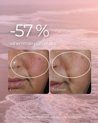 Punoitusta rauhoittava seerumi, kliininen testi