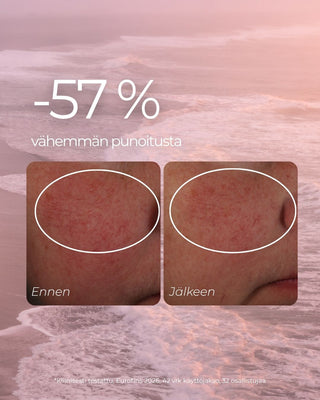 Punoitusta rauhoittava seerumi, kliininen testi