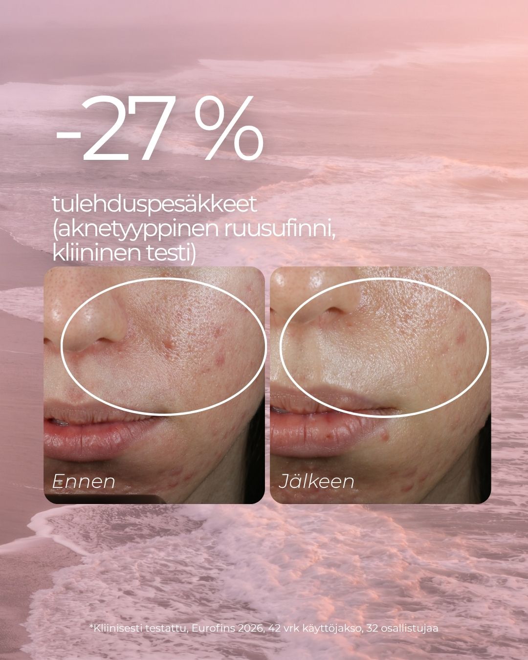 Punoitusta rauhoittava suojamuuria vahvistava seerumi ruusufinniin ja couperosaan taipuvalle iholle, hajusteeton, vegaaninen