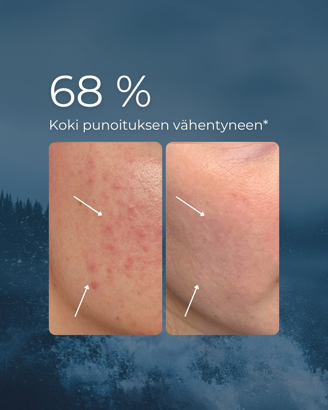 Rakkohauru Jojoba kasvoöljy ärtyneelle, punoittavalle ja epäpuhtauksiin taipuvalle iholle, vegaaninen, 100% luonnollista