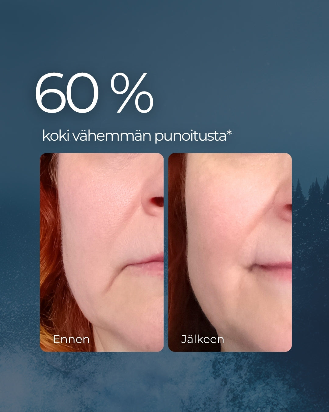 Rakkohauru & Kaktus 24H prebioottinen kasvovoide herkälle, pintakuivalle, mutta rasvoittuvalle iholle, UNISEX