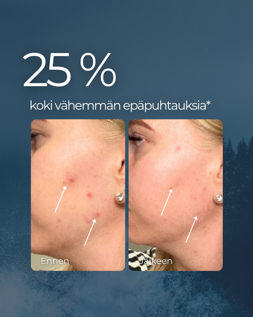Rakkohauru & Kaktus 24H prebioottinen kasvovoide herkälle, pintakuivalle, mutta rasvoittuvalle iholle, UNISEX