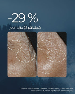 Rakkohauru silmänympärysvoide vähentää 29 % juonteita 28 päivässä