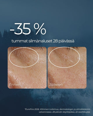 Rakkohauru silmänympärysvoide vaalentaa 35 % tummia silmänalusia 28 päivässä