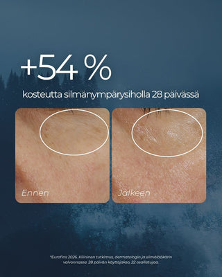 Rakkohauru silmänympärysvoide parantaa ihon kosteutta 54% 28 päivässä