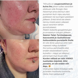 Ruusufinniä rauhoittava ihonhoitosetti, 2 tuotetta