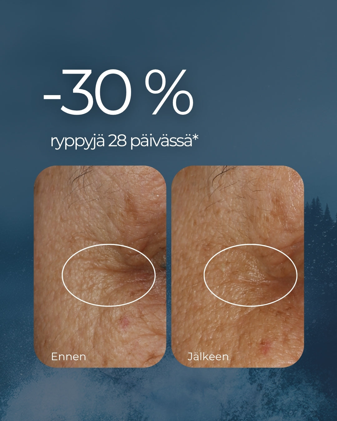 Rakkohauru Superseerumi, vähentää tutkitusti ryppyjä, maksaläiskiä, punoitusta ja ihohuokosia