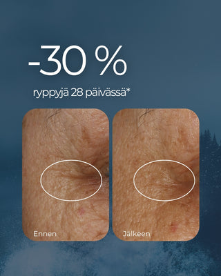 Rakkohauru Superseerumi, vähentää tutkitusti ryppyjä, maksaläiskiä, punoitusta ja ihohuokosia