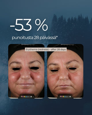 Rakkohauru Superseerumi, vähentää tutkitusti ryppyjä, maksaläiskiä, punoitusta ja ihohuokosia