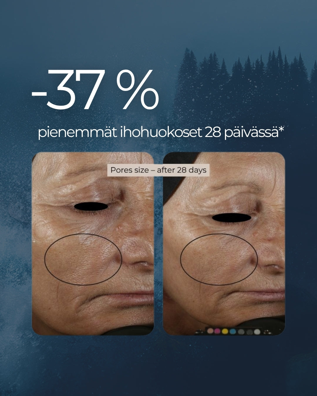 Rakkohauru Superseerumi, vähentää tutkitusti ryppyjä, maksaläiskiä, punoitusta ja ihohuokosia