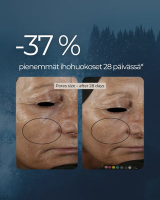 Rakkohauru Superseerumi, vähentää tutkitusti ryppyjä, maksaläiskiä, punoitusta ja ihohuokosia