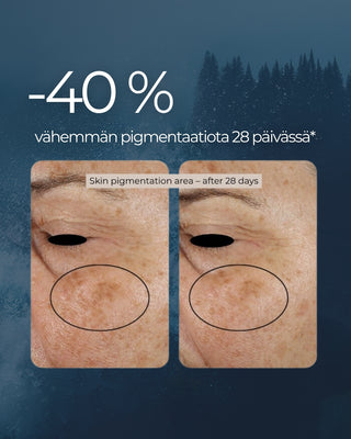 Rakkohauru Superseerumi, vähentää tutkitusti ryppyjä, maksaläiskiä, punoitusta ja ihohuokosia