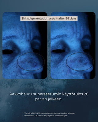 Rakkohauru Superseerumi, vähentää tutkitusti ryppyjä, maksaläiskiä, punoitusta ja ihohuokosia