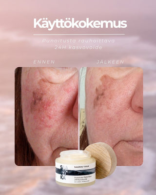 Punoitusta rauhoittava 24H kasvovoide, hajusteeton, vegaaninen, 98,86% luonnollista