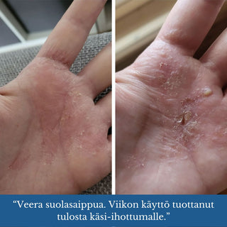 II-LAATU Veera Suolasaippua®, sopii mm. atooppiselle iholle, kutiavalle iholle, akneiholle, 100% luonnollinen, vegaaninen Suolasaippua Saaren Taika